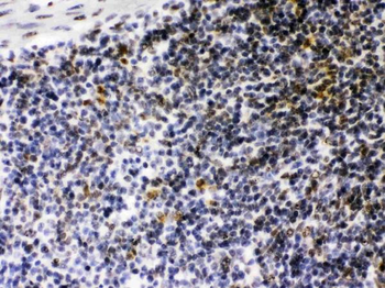 CIITA Rabbit Polyclonal Antibody