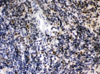 CIITA Rabbit Polyclonal Antibody