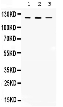 CIITA Rabbit Polyclonal Antibody