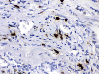 Carboxypeptidase B2/CPB2 Rabbit Polyclonal Antibody