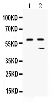Carboxypeptidase B2/CPB2 Rabbit Polyclonal Antibody