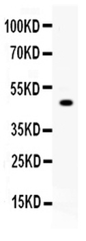 Carboxypeptidase B2/CPB2 Rabbit Polyclonal Antibody