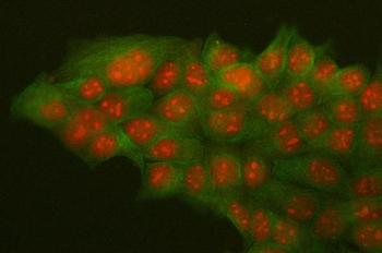 HMGB2 Antibody