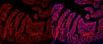 HMGB2 Antibody
