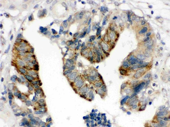 HMGB2 Antibody