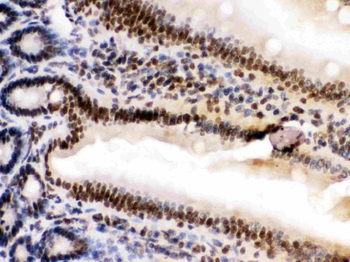 HMGB2 Antibody