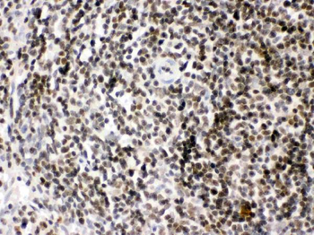 HMGB2 Antibody