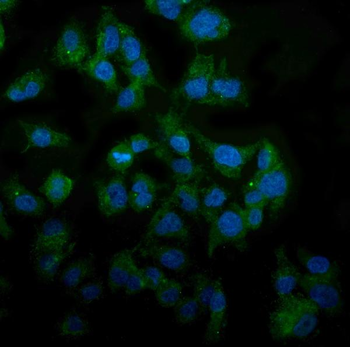 MAP3K8 Antibody