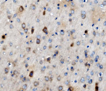 MAP3K8 Antibody
