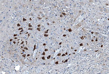 MAP3K8 Antibody