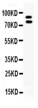 MMP9 Rabbit Polyclonal Antibody