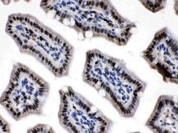 Visfatin/NAMPT Antibody