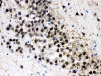 ZWINT Rabbit Polyclonal Antibody