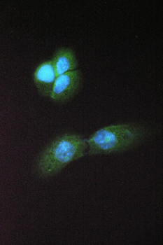 Abhd5 Rabbit Polyclonal Antibody