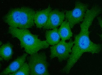 ATP citrate lyase/ACLY Antibody