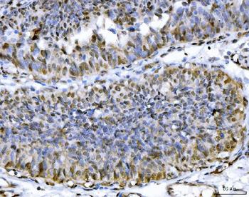 ATP citrate lyase/ACLY Antibody