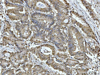 ATP citrate lyase/ACLY Antibody
