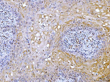 ATP citrate lyase/ACLY Antibody