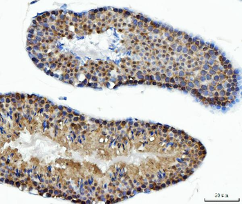 ATP citrate lyase/ACLY Antibody
