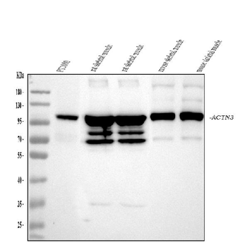 ACTN3 Antibody