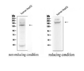 ADAMTS13 Rabbit Polyclonal Antibody