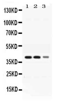 ADH4 Rabbit Polyclonal Antibody