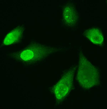 ADK Rabbit Polyclonal Antibody