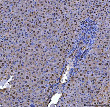 ADK Rabbit Polyclonal Antibody
