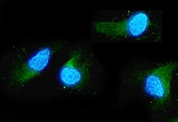 ADO Antibody