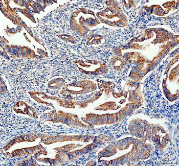 Adenylate Kinase 1/AK1 Rabbit Polyclonal Antibody