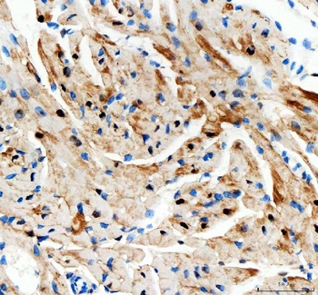 Adenylate Kinase 1/AK1 Rabbit Polyclonal Antibody