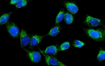AK2 Rabbit Polyclonal Antibody
