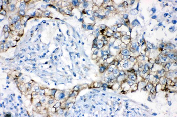 AK2 Rabbit Polyclonal Antibody