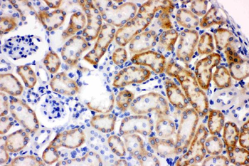 AK2 Rabbit Polyclonal Antibody
