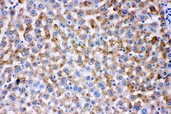 AK2 Rabbit Polyclonal Antibody
