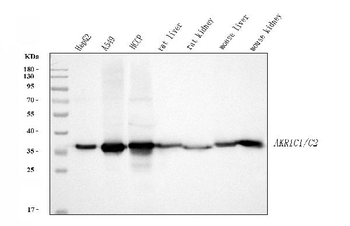 AKR1C1/C2 Rabbit Polyclonal Antibody