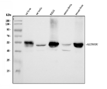 ALDH1B1 Antibody