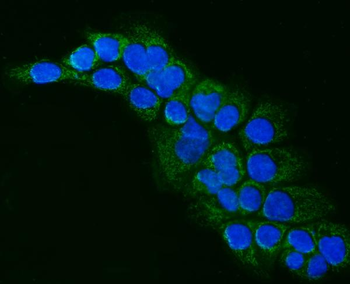 ALDH1B1 Antibody