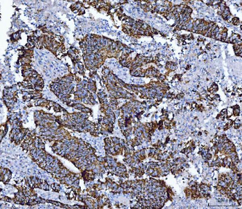 ALDH1B1 Antibody