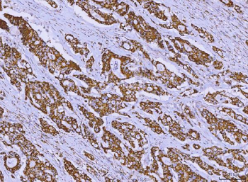 ALDH1B1 Antibody
