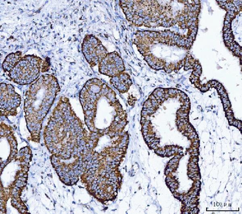 ALDH1B1 Antibody