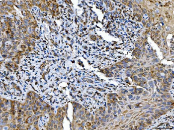 ALDH1B1 Antibody