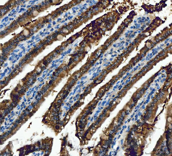 ALDH1B1 Antibody