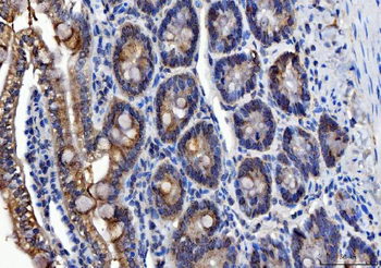 ALDH1B1 Antibody