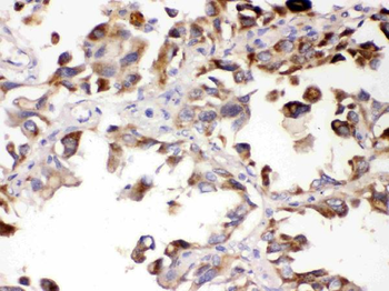 ALDH7A1 Rabbit Polyclonal Antibody