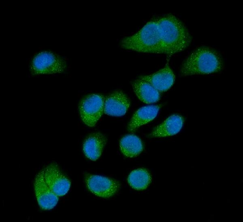 AMFR Rabbit Polyclonal Antibody