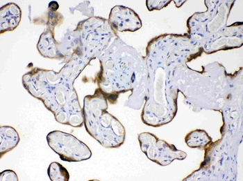 AMFR Rabbit Polyclonal Antibody