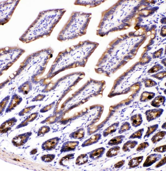 AMFR Rabbit Polyclonal Antibody