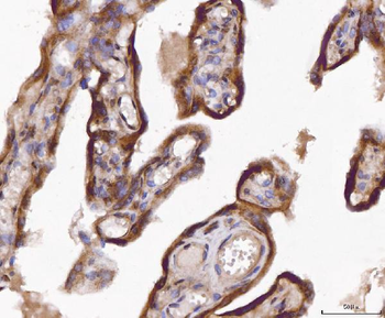 ABP1/AOC1 Rabbit Polyclonal Antibody
