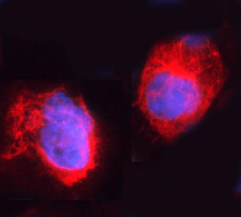 ARHGEF1 Rabbit Polyclonal Antibody